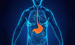 Acid Reflux