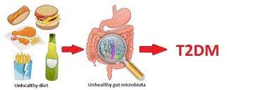 Diabetes in the Gut
