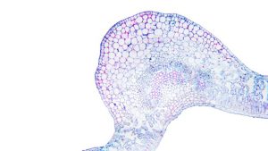 What Are Digestive Enzymes