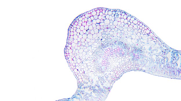 What Are Digestive Enzymes