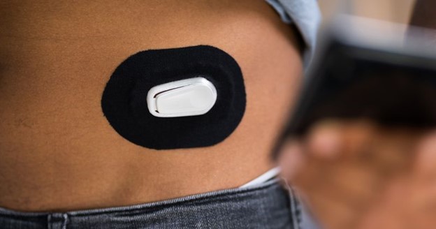 CGM Use Lowers Hospitalizations, May Reduce Mortality in Type 1 and Type 2 Diabetes